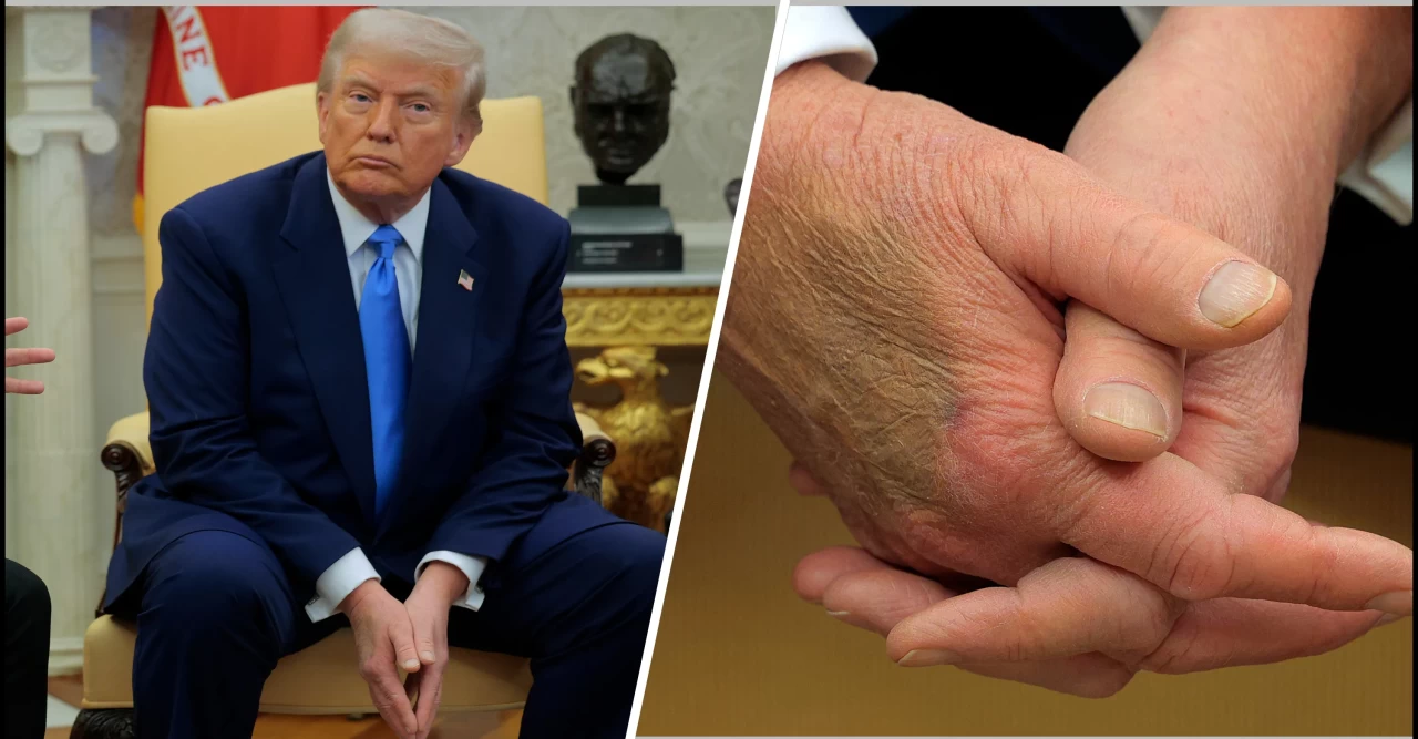 Trump's Troubling Mental State: Allegations of War Crimes Against Trump and Netanyahu