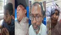 চৌদ্দগ্রামে জামায়াত-বিএনপি সমর্থকদের মধ্যে রক্তক্ষয়ী সংঘর্ষ- আহত ১৫